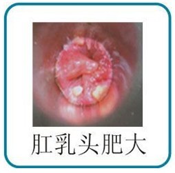 201303181508550507.jpg
