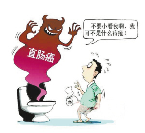 直肠癌