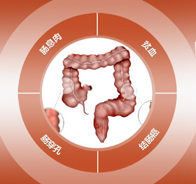 结肠炎危害