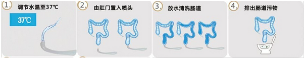 大肠水疗过程