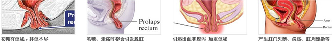 肛门湿疹