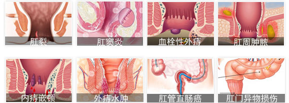 肛门疼的病因