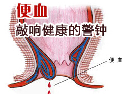 滴血原因