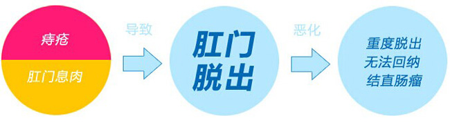 脱出原因