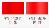 便血颜色与疾病1