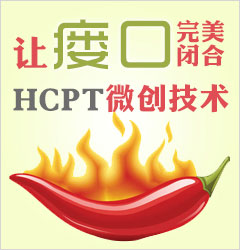 肛瘘hcpt
