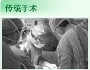 传统手术