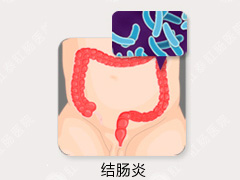 结肠炎