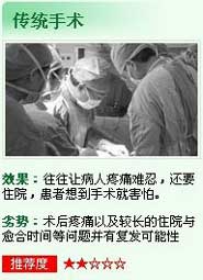 传统切除术