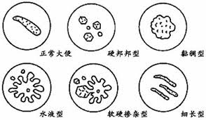 大便形状