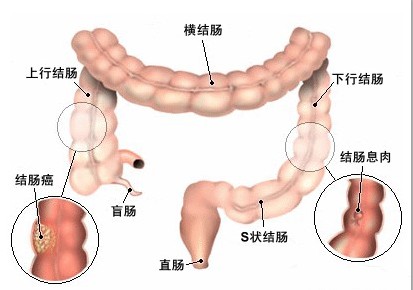 肠liu