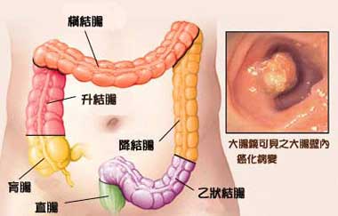 肠liu