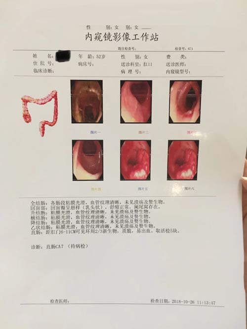 直肠肿瘤报告检查单