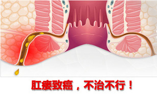 恶变危险